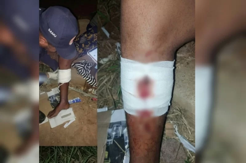 Um jovem de 18 anos foi baleado na perna durante o ataque/ Foto: Divulgação