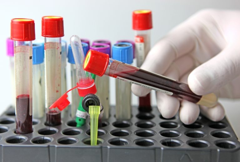 Lei que regulamenta atuação de nutricionista prevê pedido de exames - (Foto: Depositphotos)