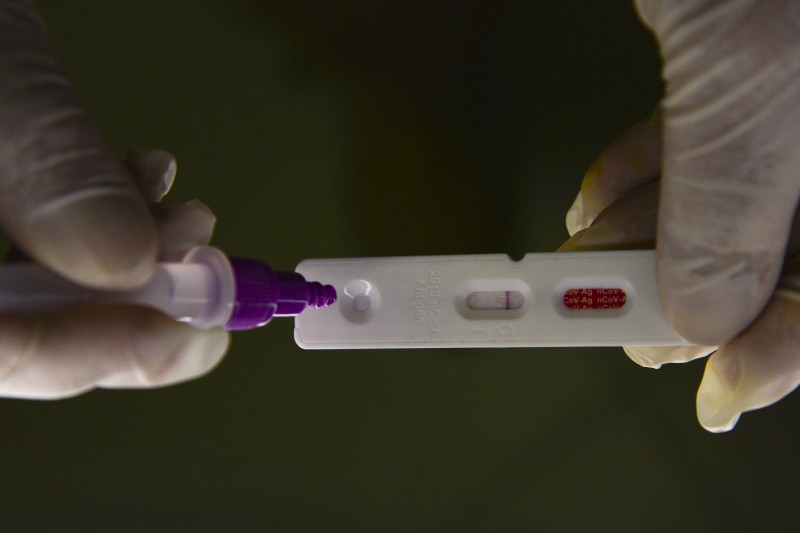 País registra 11.722 casos de covid-19 e 92 mortes em 24 horas