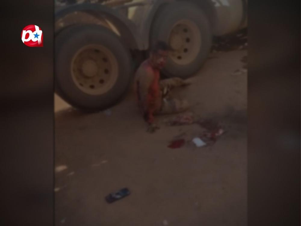 Caminhoneiro é baleado em Marabá por colega de profissão